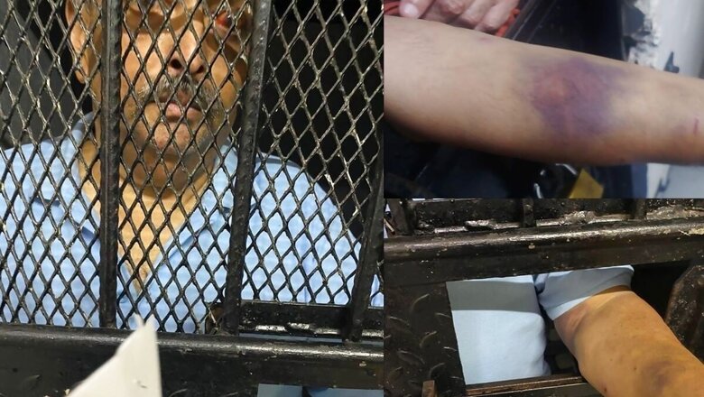 Mehul Choksi Alleges Kidnapping by India, Says Left With Permanent Scars