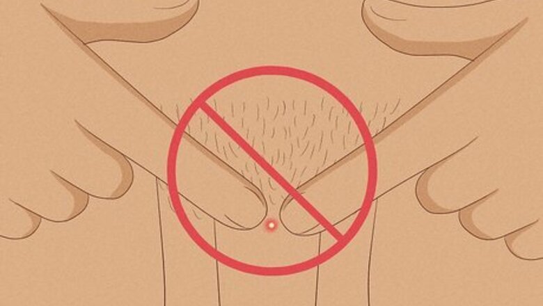 Pimples in the Male Pubic Area: Causes, Treatments & Prevention
