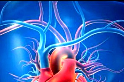 Sodium Glucose Co Transporter 2 Inhibitors Useful in Treating Preserved Ejection Fraction