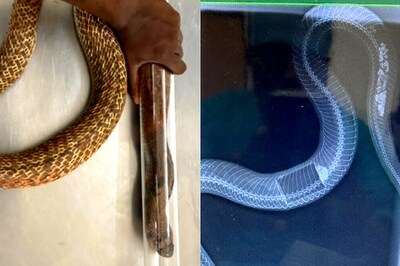 Cobra Operated Upon After it Swallowed Plastic Box, Broken Egg Shells