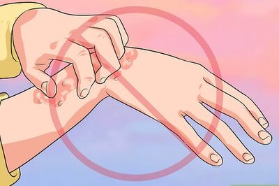 How to Lessen Fiberglass Itch