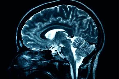 Chinese man hospitalised with 100-kg tumour