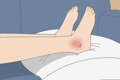 How to Reduce Swelling  for Minor Injuries