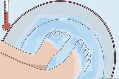 How to Remove Calluses Naturally