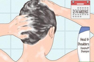 How to Prevent and Treat Dandruff