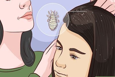 How to Get Rid of Lice