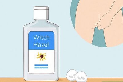 How to Treat Hemorrhoids with Witch Hazel
