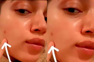 Bhumi Pednekar Shares Her Pimple Woes