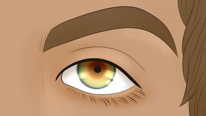 A Complete Guide to Hazel Brown Eyes: Color, Causes, & Rarity