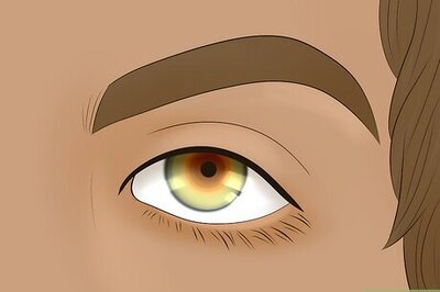 A Complete Guide to Hazel Brown Eyes: Color, Causes, & Rarity
