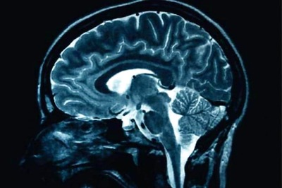 Positive Attitude Helps Guard Against Memory Problems