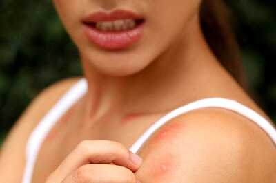 Mosquito Magnets: Know Which Blood Groups Are More Prone and Why?