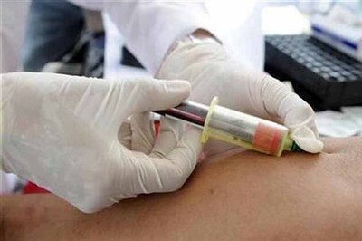 Better HIV screening worthwhile in US