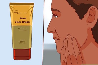 How to Get Rid of Pimples with Aloe Vera Gel