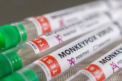 ICMR-NIV Analysis Finds A.2 Strain of Monkeypox Virus in First Two Cases