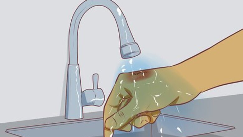 How to Quickly Treat a Cut or Bleeding Scrape