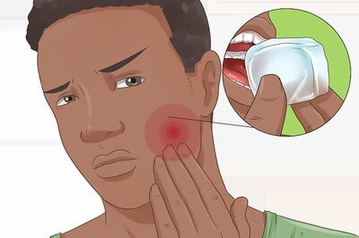 How to Know if Your Dental Fillings Need Replacing