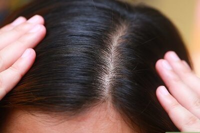 How to Determine Hair Type