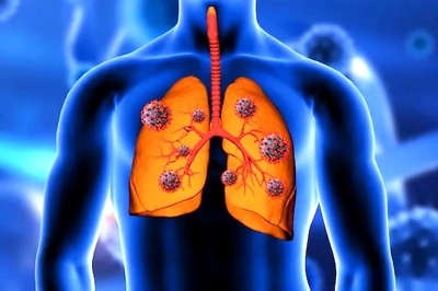 5 Tips To Protect Your Lungs Amid Rising Air Pollution Levels