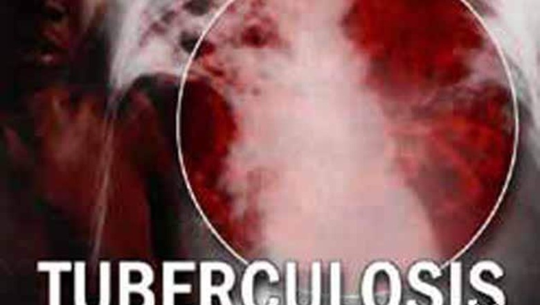 London, tuberculosis capital of Western Europe
