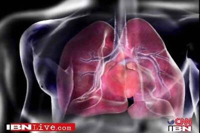 Heart harvested in Bangalore, transplanted in Chennai