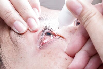 What Happens If You Use An Eye Drop A Month After Opening It
