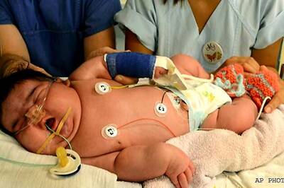 Snapshot: Jasleen, the baby born in Germany who weighs 13.47 pounds
