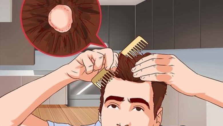 How to Know if You Have Ringworm