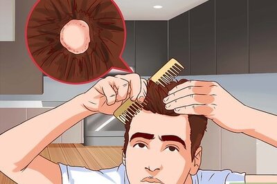 How to Know if You Have Ringworm