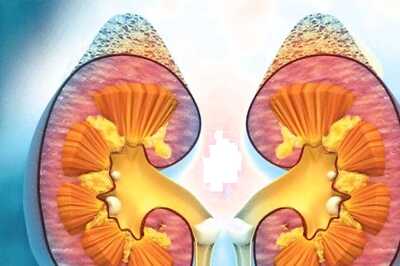 Avoiding Junk Food To Staying Hydrated, 6 Tips To Maintain A Healthy Kidney