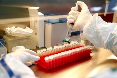 Sira Congress Candidate T B Jayachandra Tests Positive for Covid-19 Ahead of Bypoll Results