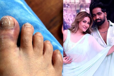 Urvashi Dholakia On Jhalak Dikhhla Jaa 11: 'Injury Or No Injury, I Just Want To Dance'