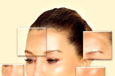 The Complete Hyperpigmentation Facts You Need