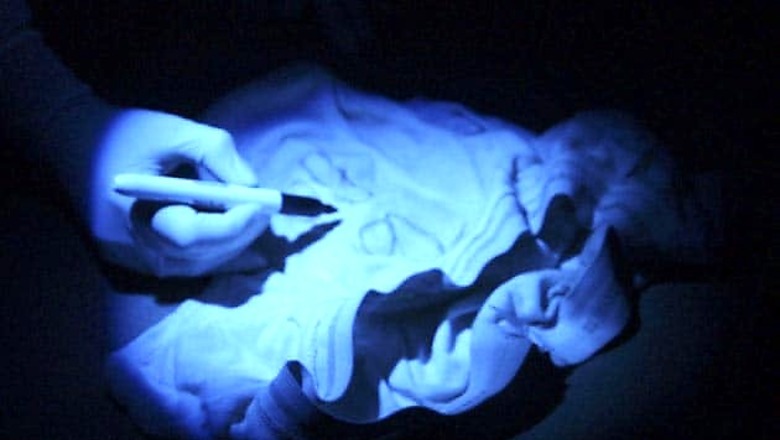 Now, a hands-free sperm extractor for donors