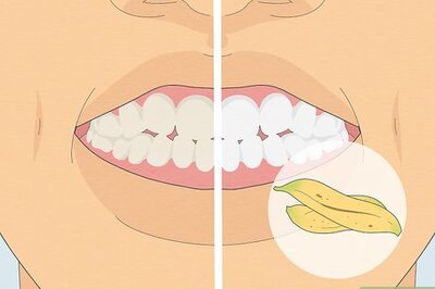 How to Whiten Your Teeth with Banana Peel