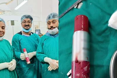 Doctors Remove Bottle of Deodorant from 27-year-old Man's Stomach in Kolkata