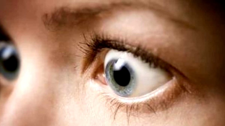 Is Thyroid Eye Disease Contagious? Know Its Symptoms, Causes And Prevention