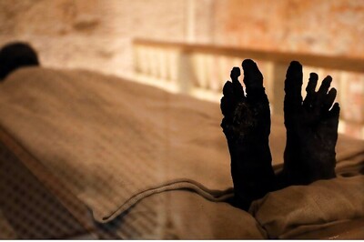 First Suspected Fatality in India as 76-Year-Old Man Dies in Karnataka