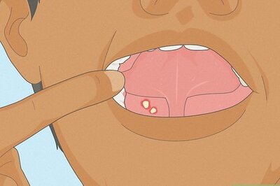 How to Tell if You Have Mouth Cancer