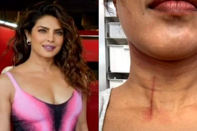 Priyanka Chopra Gets a HUGE Cut on Her Throat While Filming Stunt Scenes For The Bluff; Shares Pic