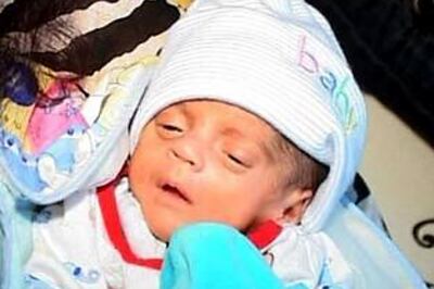 Jaipur doctors save world’s lightest baby