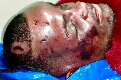 Trooper Probed In Black Man's Death Critically Hurt In Crash