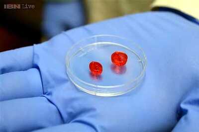 Scientists can now 3D print human blood vessels