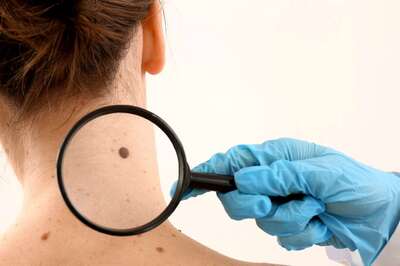Don’t Ignore These Alarming Symptoms of Skin Cancer