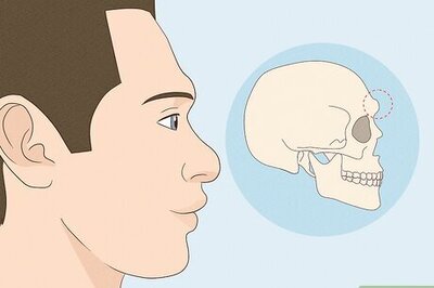 Prominent Brow Ridges Explained (Plus, How to Minimize Them)