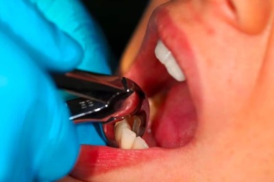 23-Year-Old Chinese Man Dies After Double Teeth Extraction Led To Intracranial Bleeding