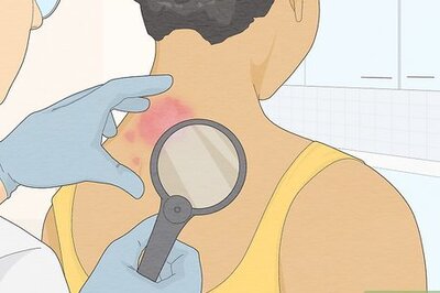 How to Read Allergy Skin Test Results