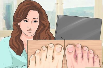 How to Tell if You Have an Ingrown Toenail