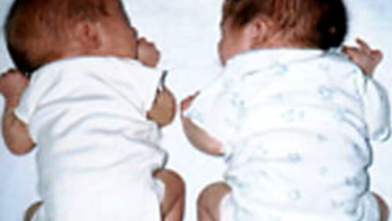 Father sells twins for Rs 100