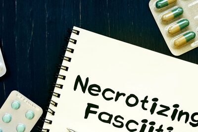 What Is Necrotizing Fasciitis? Who Does This Rare Condition Affect And How To Spot It?